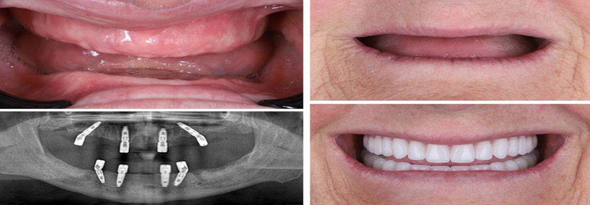 Photo of My Implant Dentist South Perth