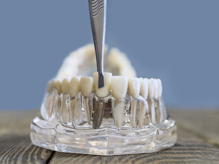 Photo of Coolamon Dental Centre Ellenbrook